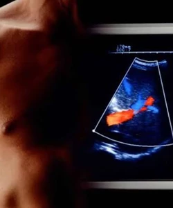 Advanced Transesophageal Echocardiography Course