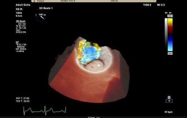 Heart Failure Echocardiography Registry