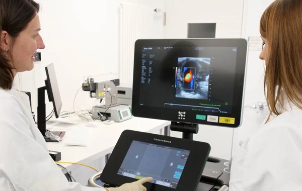 Call for Researchers: Echocardiography Database Project